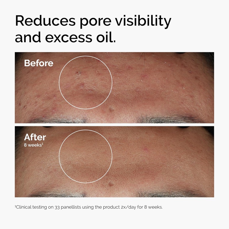 The Ordinary Niacinamid Serum wird mit der Pipette auf die Hand aufgetragen